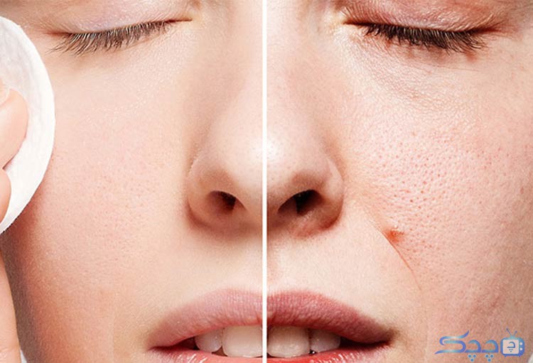 روشن شدن پوست صورت: راه‌هایی برای داشتن پوستی درخشان و جذاب
