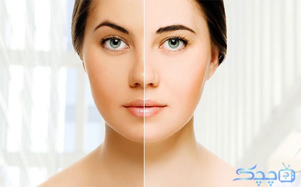 روشن شدن پوست صورت: راه‌هایی برای داشتن پوستی درخشان و جذاب