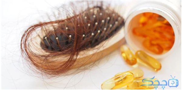 برای جلوگیری از ریزش مو، چه ویتامینی بخوریم؟