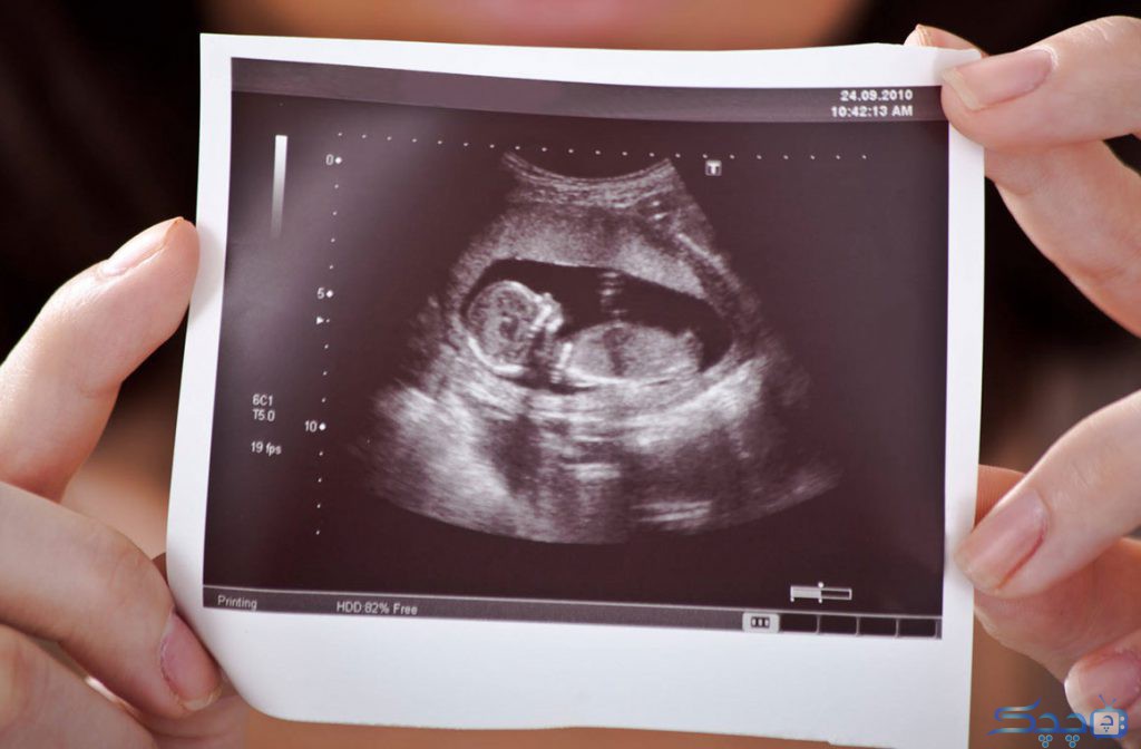 آیا سونوگرافی برای جنین ضرر دارد؟